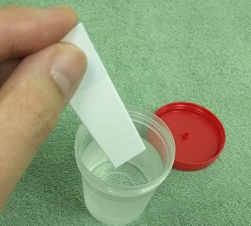 urine collection for environmental pollutants test